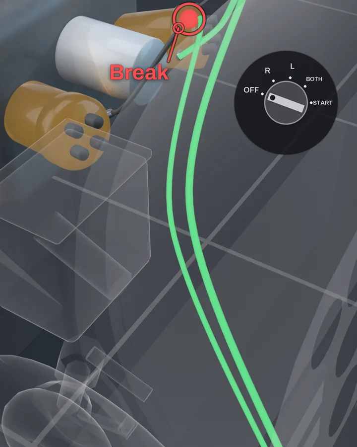 A gold magneto with its green ground wire running down toward the cockpit, a red ring labelled Break where the wire is broken at the magneto, and an inset of the ignition key turned to OFF.